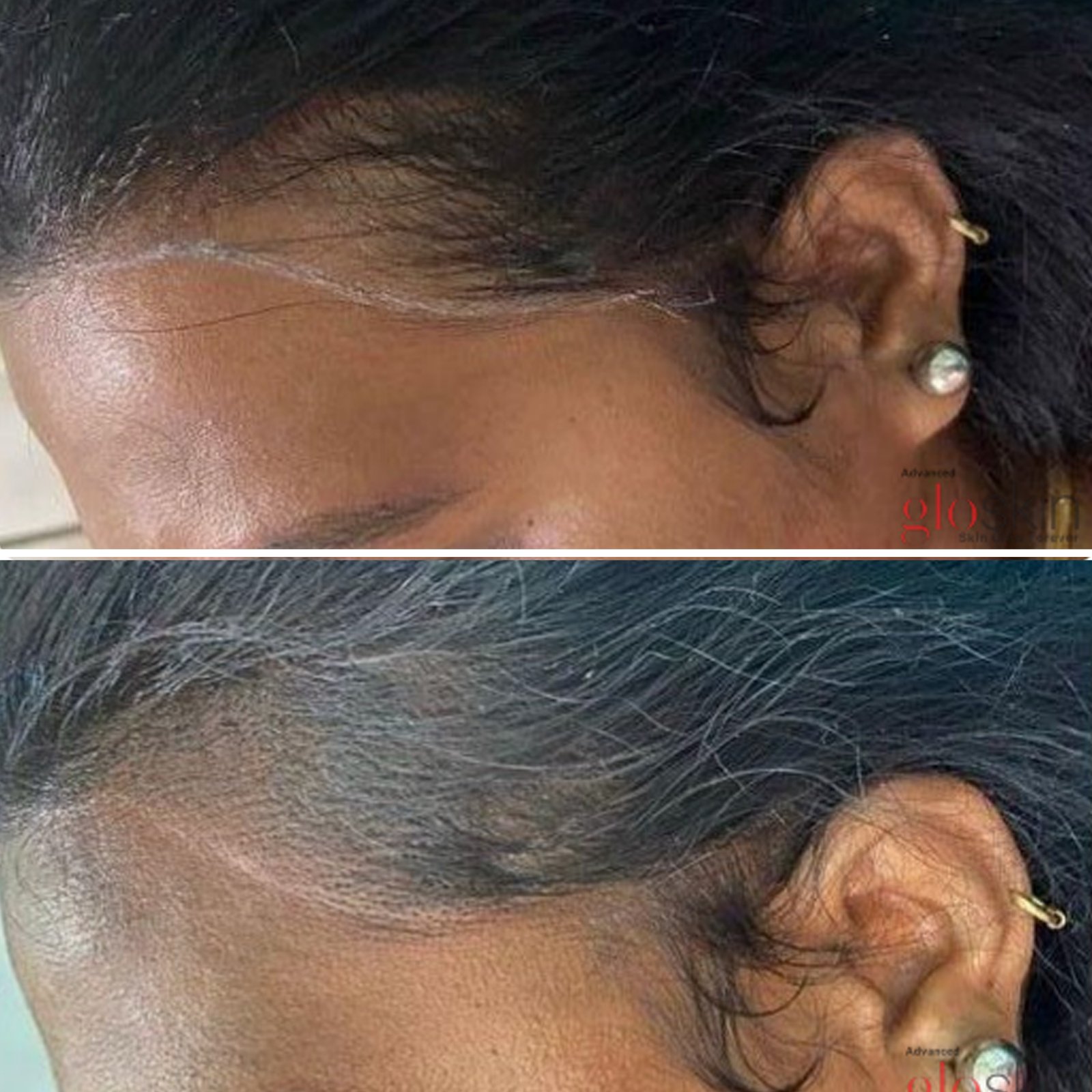 gro-hair-glo-skin-thanjavur