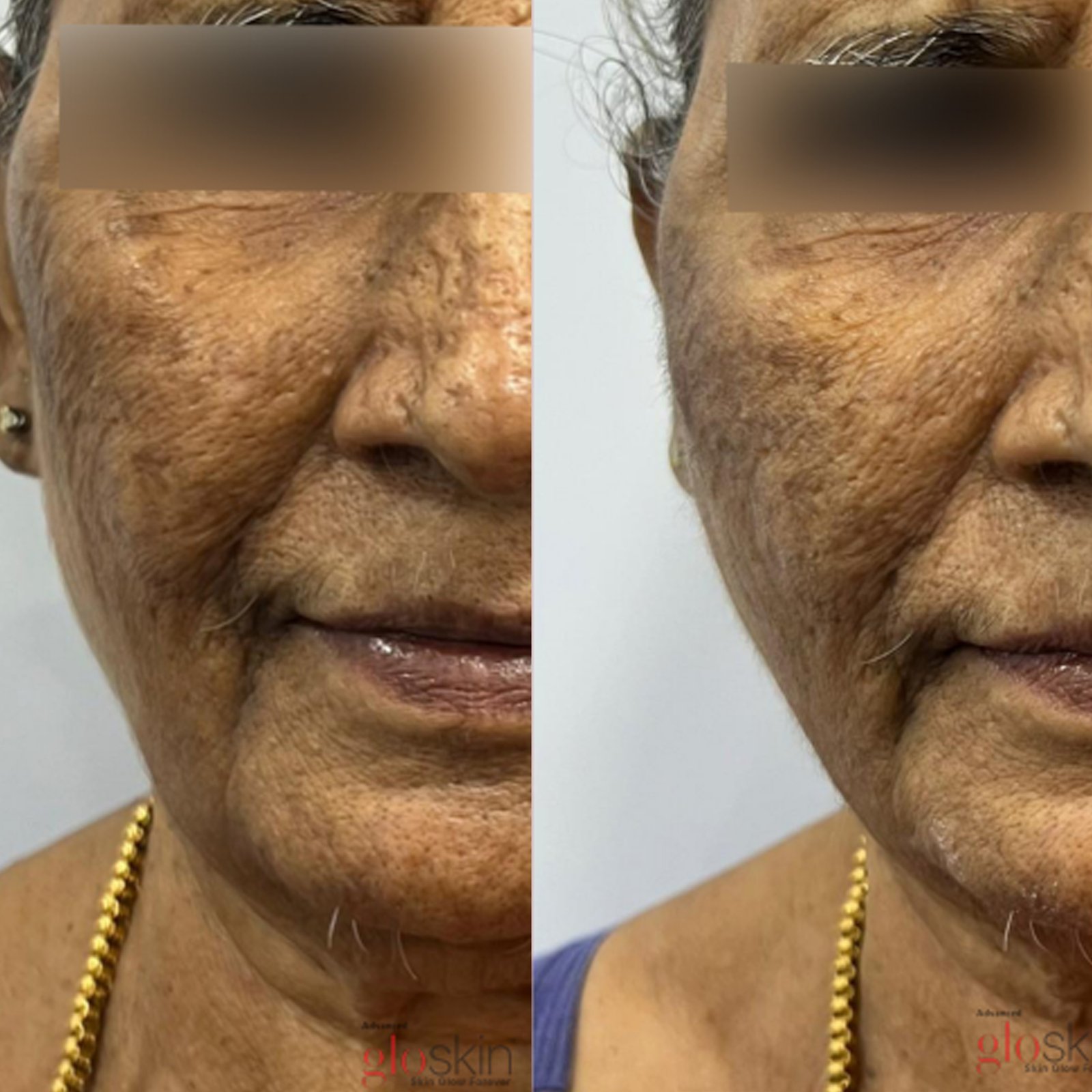 gro-hair-glo-skin-thanjavur